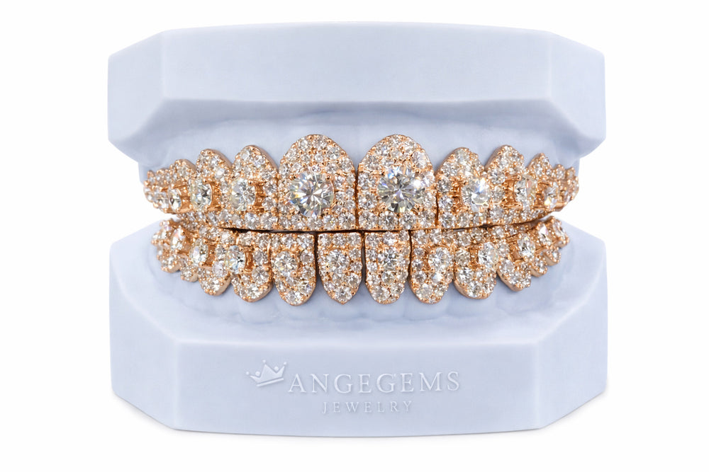VVS MOISSANITE DIAMOND GRILLZ (HONEYMOON SETTING)