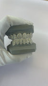 Custom Moissanite VVS Grillz (HoneyComb)
